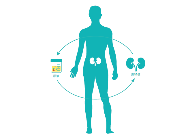 BK病毒相关性肾病无创检测