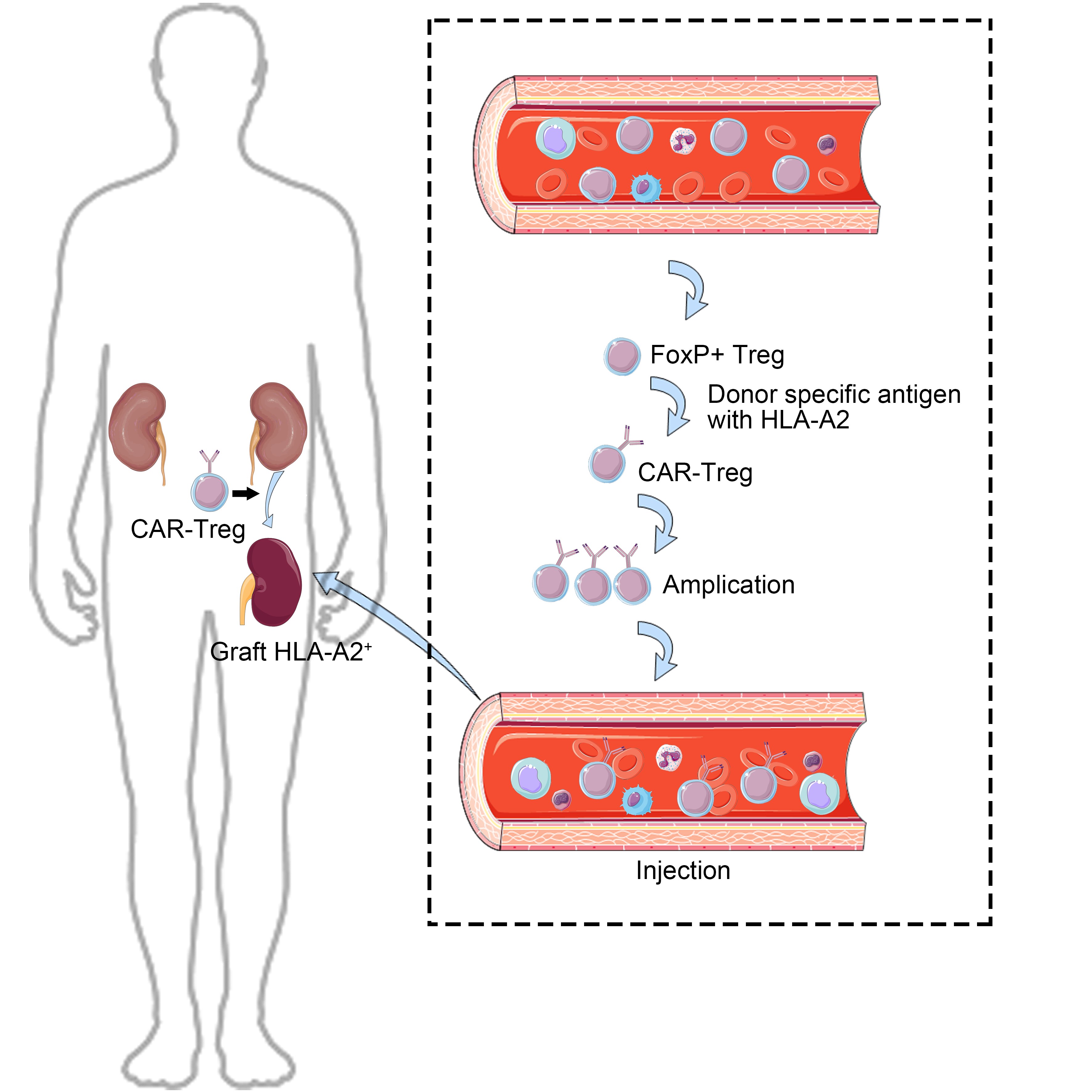 CAR-Treg服务平台